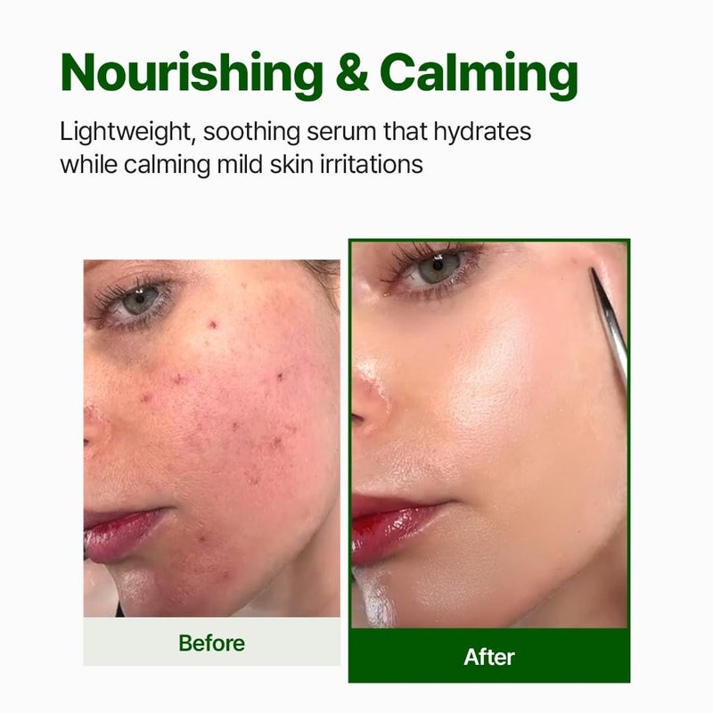 NACIFIC Cica PDRN Calming Serum 1.69 fl oz 50ml, Centella Asiatica, Soothing, Hydrating Barrier Repair for Sensitive Skin, Redness Relief, Korean Skincare, Stocking Stuffers, Christmas Gifts for Women - Image 3